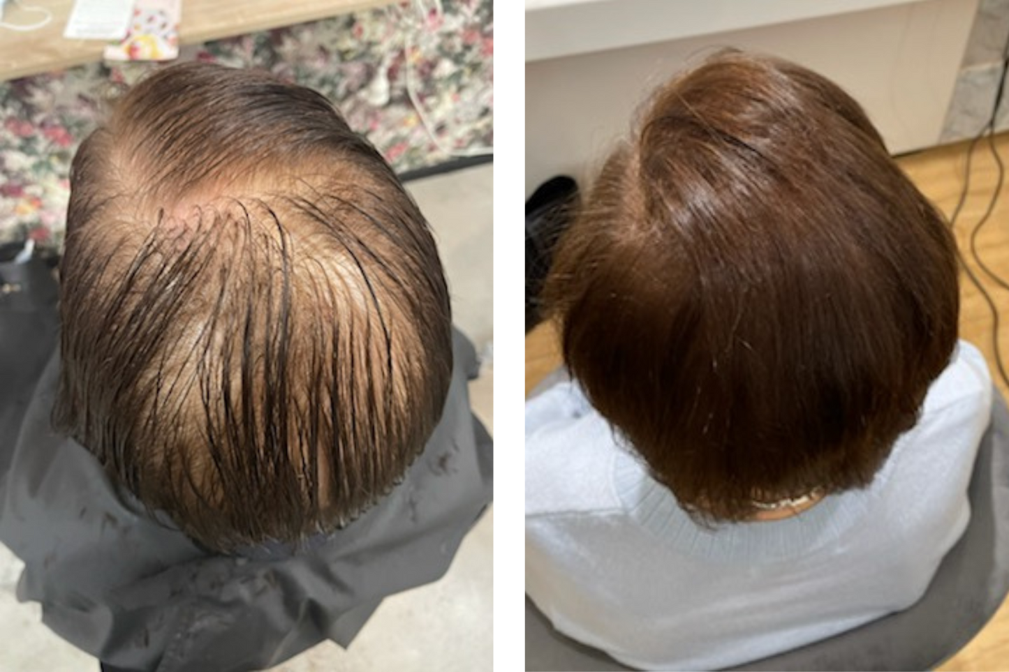 KiriGlow | Keratin Starter Bundle