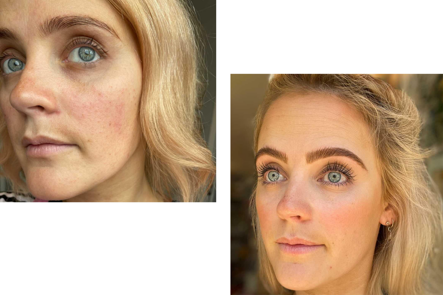 KiriGlow | Keratin Supplement for Hair, Skin and Nails