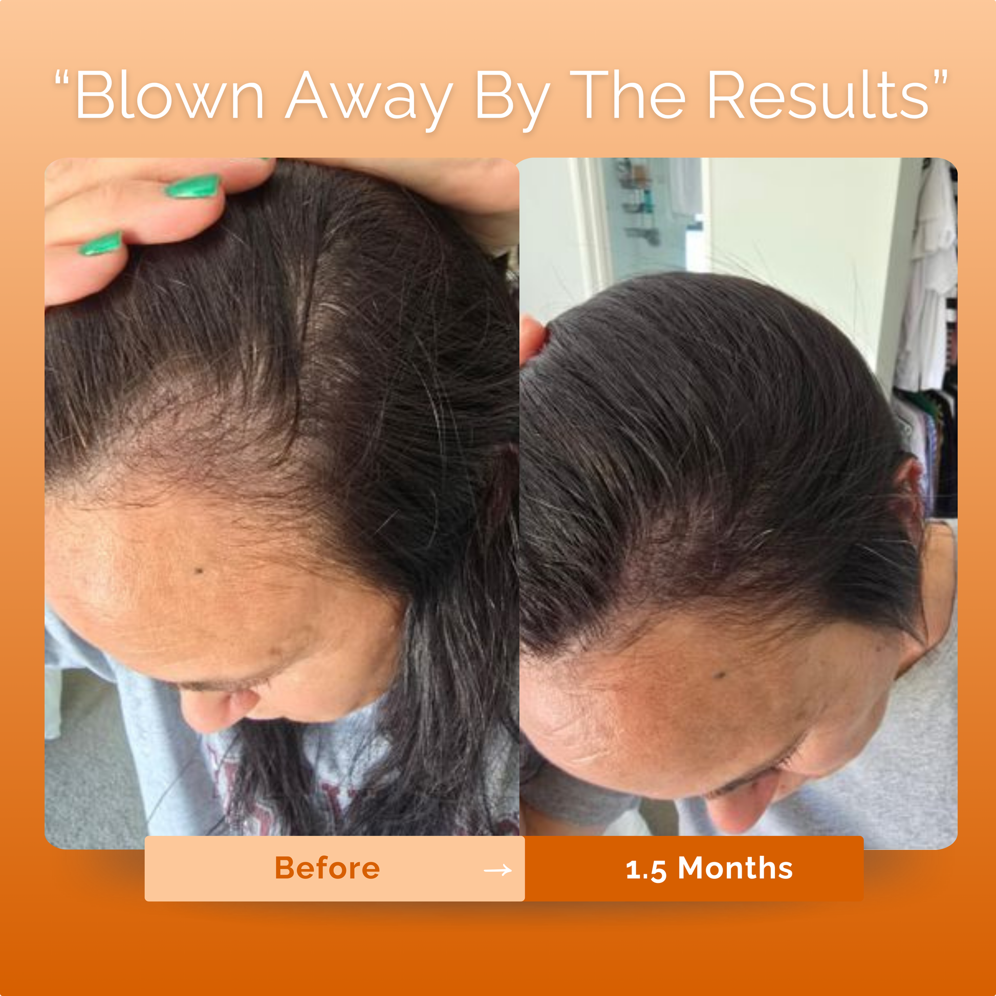 KIRIGLOWâ„¢ | Keratin Hair Growth Supplement