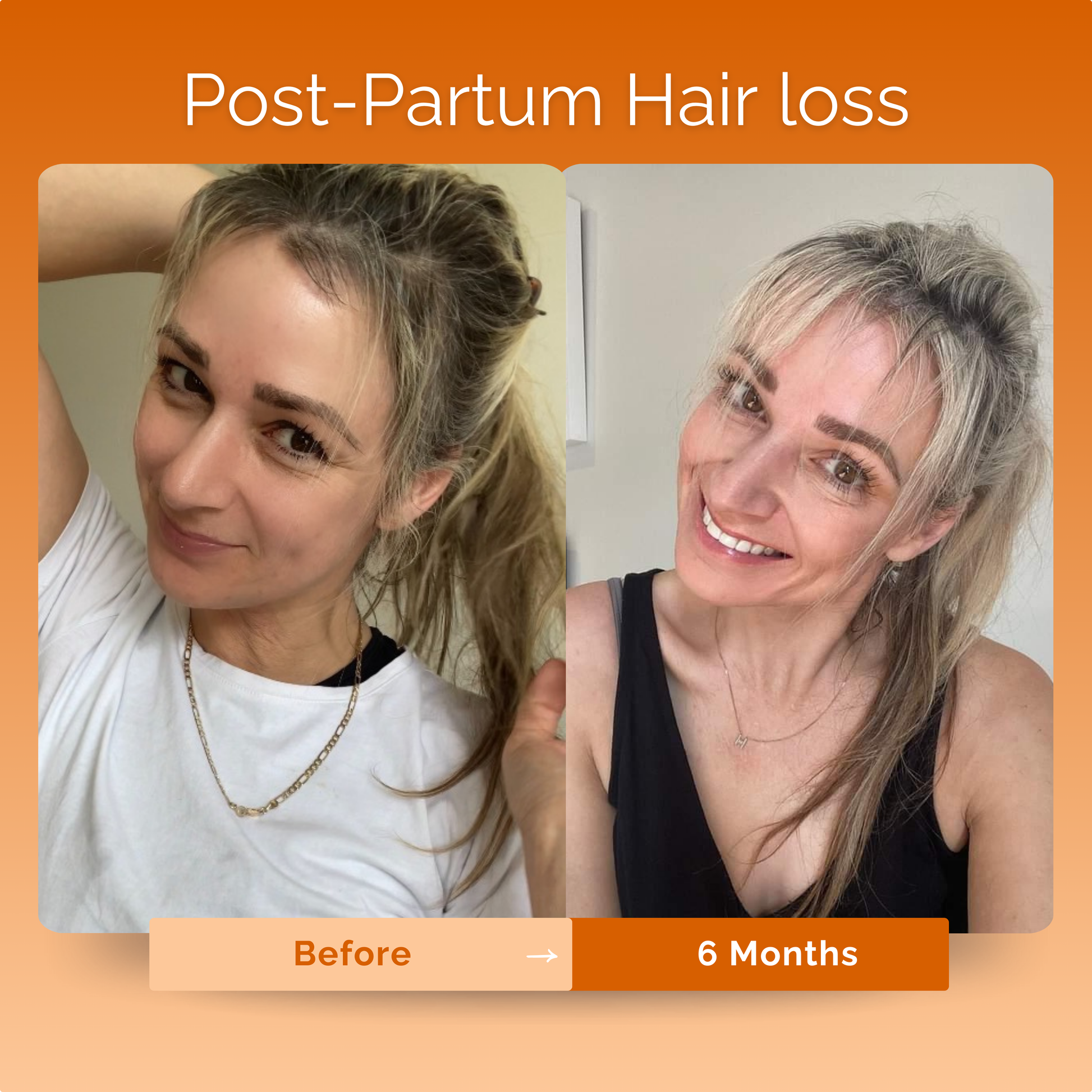 KIRIGLOWâ„¢ | Keratin Hair Growth Supplement