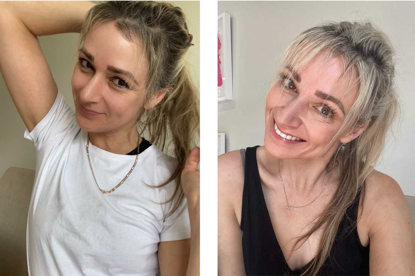 KiriGlow | Keratin Supplement for Hair, Skin and Nails