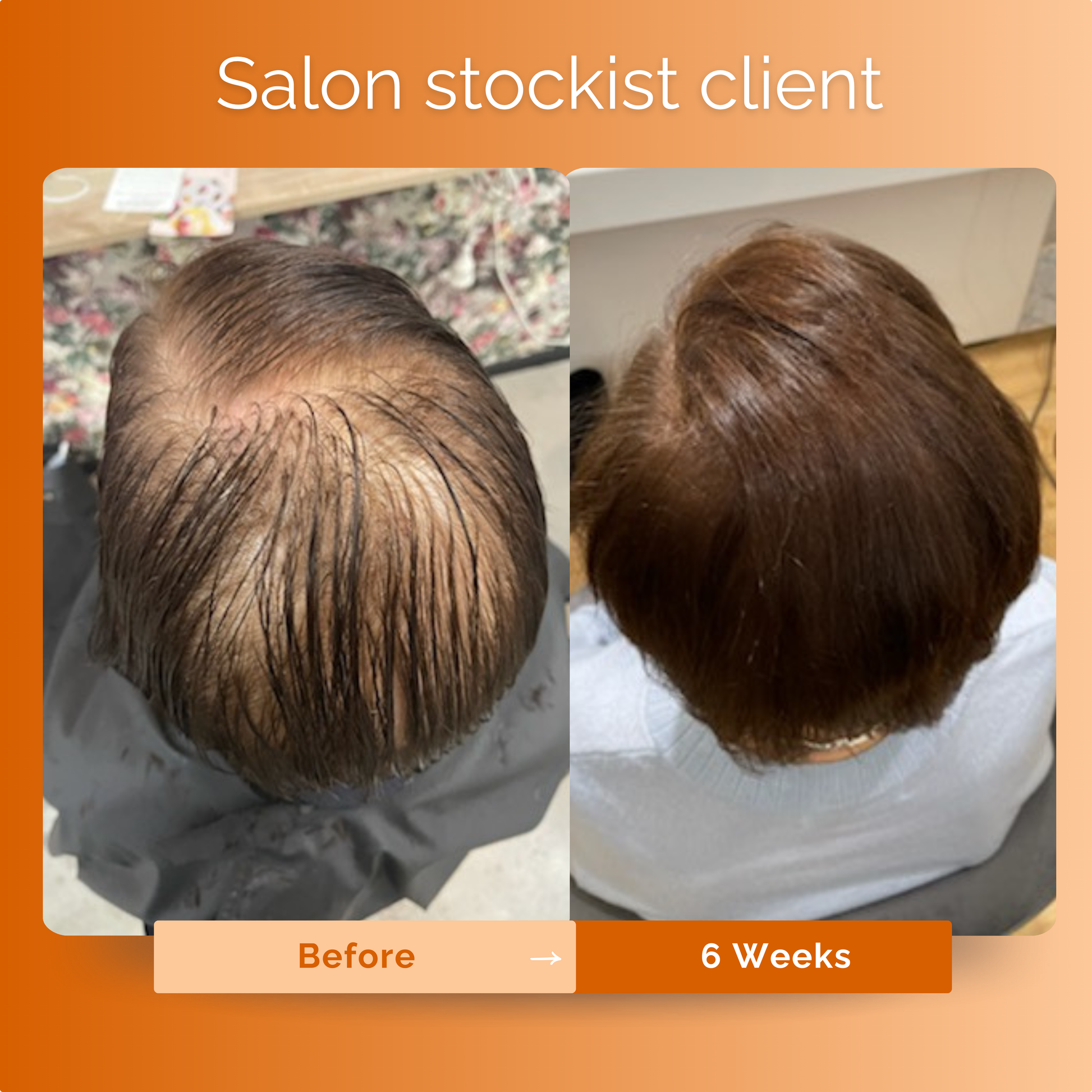 KIRIGLOWâ„¢ | Keratin Hair Growth Supplement