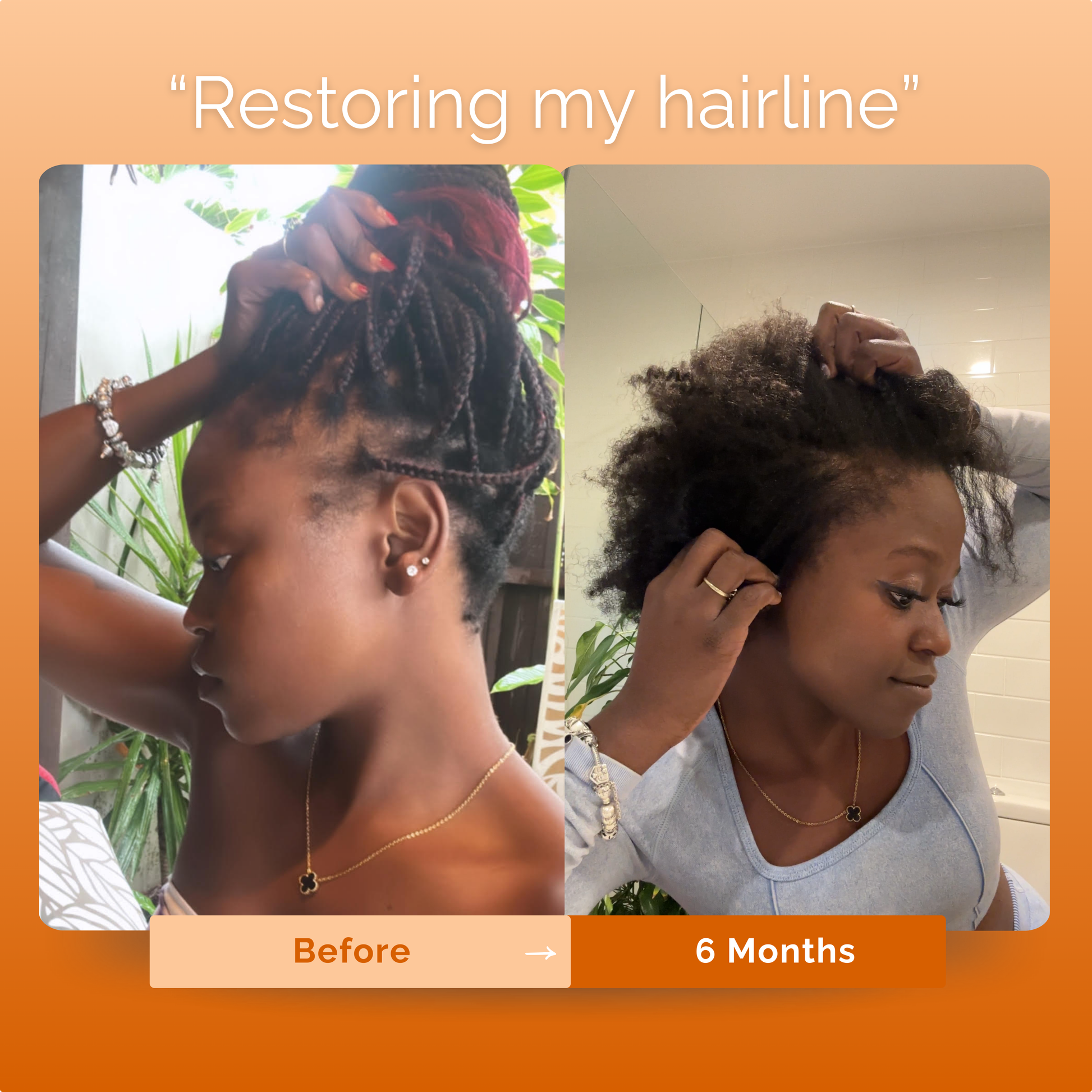 KIRIGLOWâ„¢ | Keratin Hair Growth Supplement