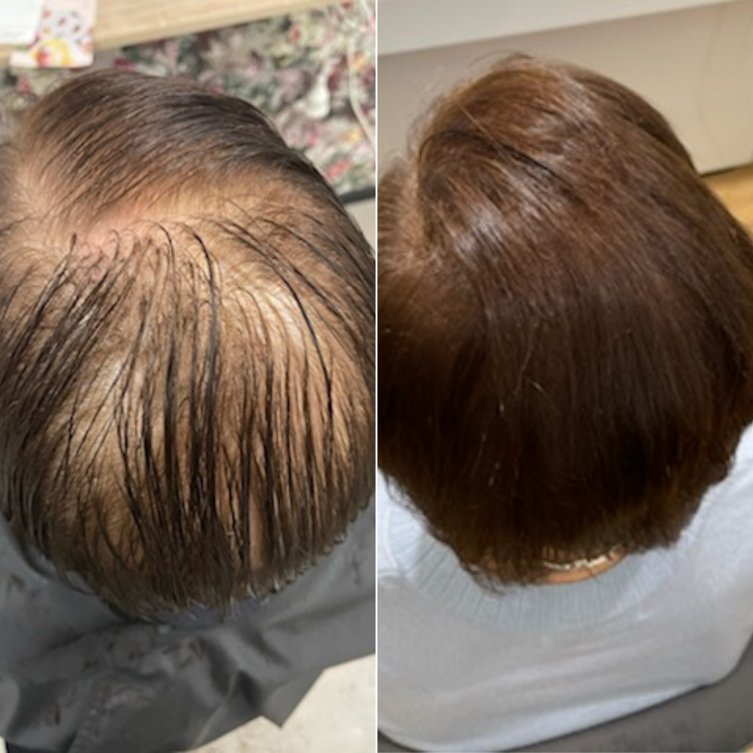 KIRICARE™ | Glow Pro Bundle – Your 4-Step Hair Growth System