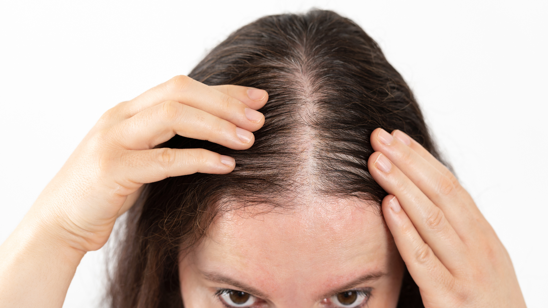 Female Hair Loss Treatment New Zealand: The September Reality 40% of Kiwi Women Don't Talk About