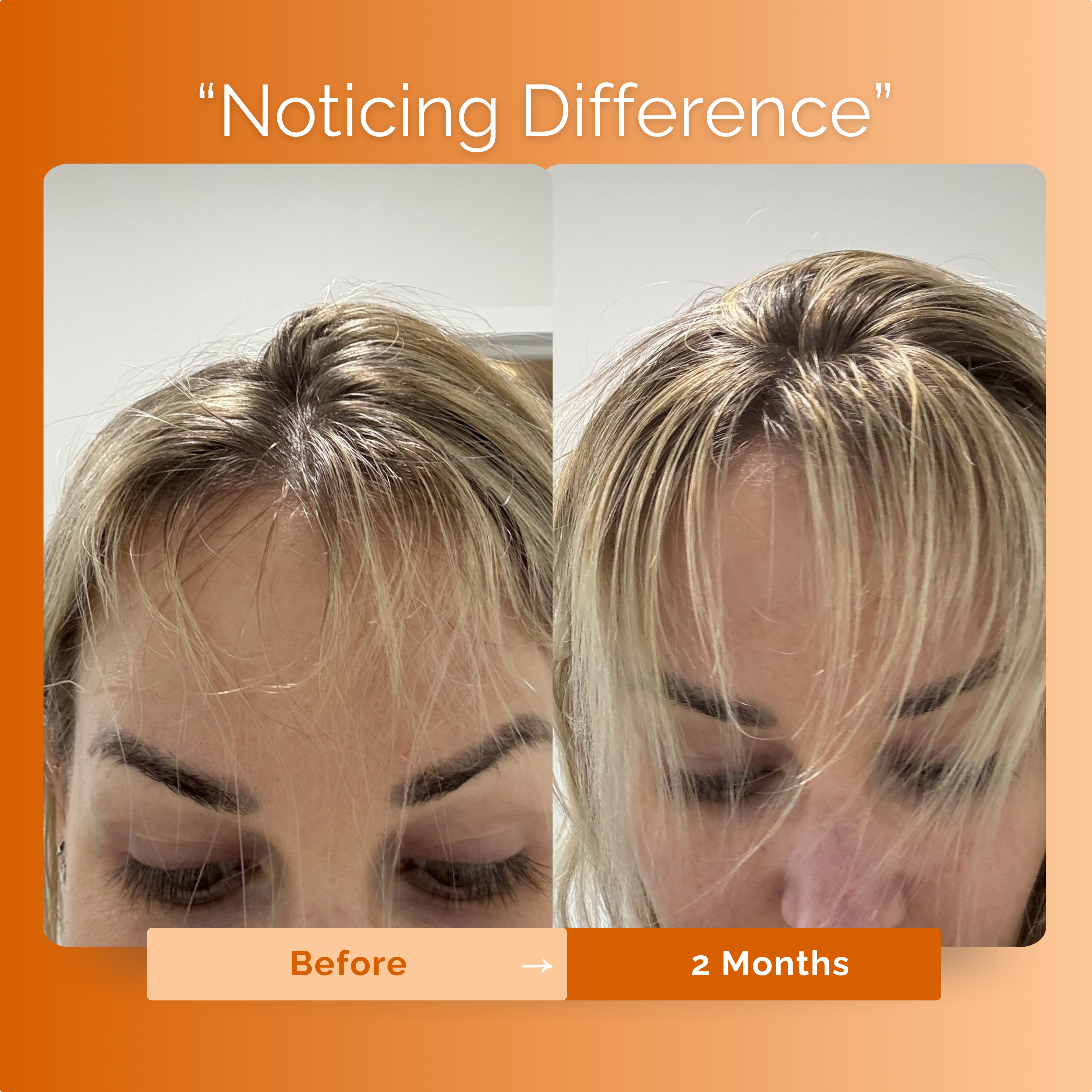 KIRIGLOW™ | Keratin Hair Growth Supplement