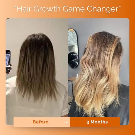 KIRIGLOW™ | Keratin Hair Growth Supplement